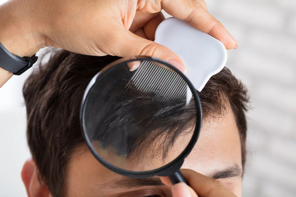 Lice Life Cycle How Long Do Head Lice Live? LiceDoctors